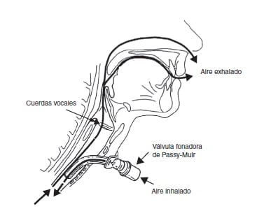 USO DE LA VALVULA DE FONACION